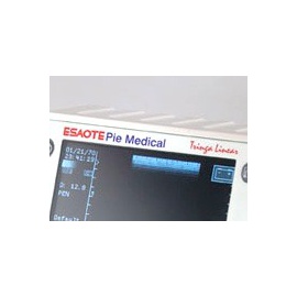 Internal battery 12V ultrasound Esaote Pie medical Tringa Linear