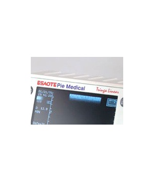 Internal battery 12V ultrasound Esaote Pie medical Tringa Linear